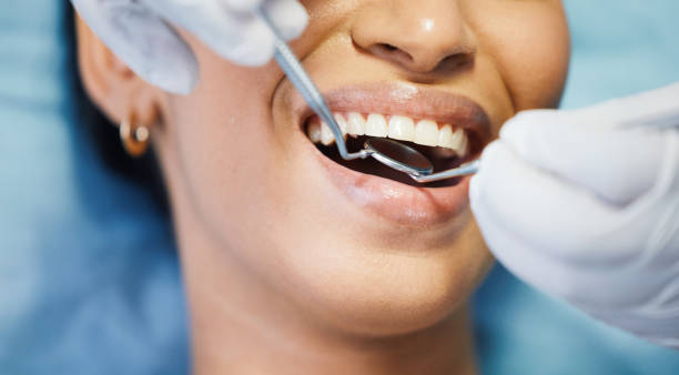 Best Broken or Chipped Tooth Repair in Woodville, CA