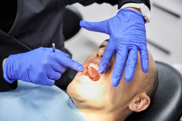 Best Emergency Wisdom Tooth Extraction in Woodville, CA